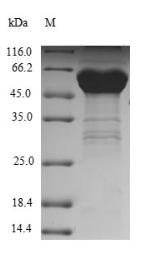 SDS-PAGE (SMARCA4-5521H).jpg
